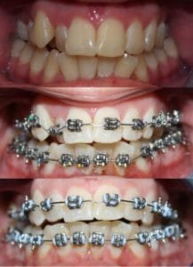 Guelph Orthodontics