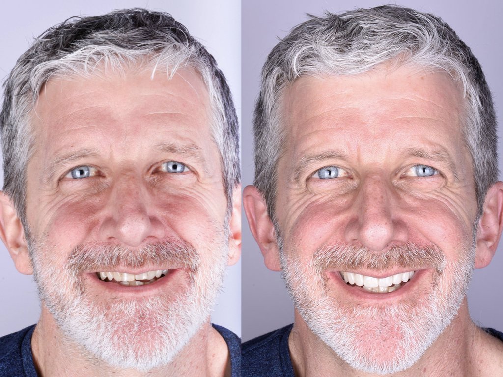 What Can You Expect from Cosmetic Dentistry?