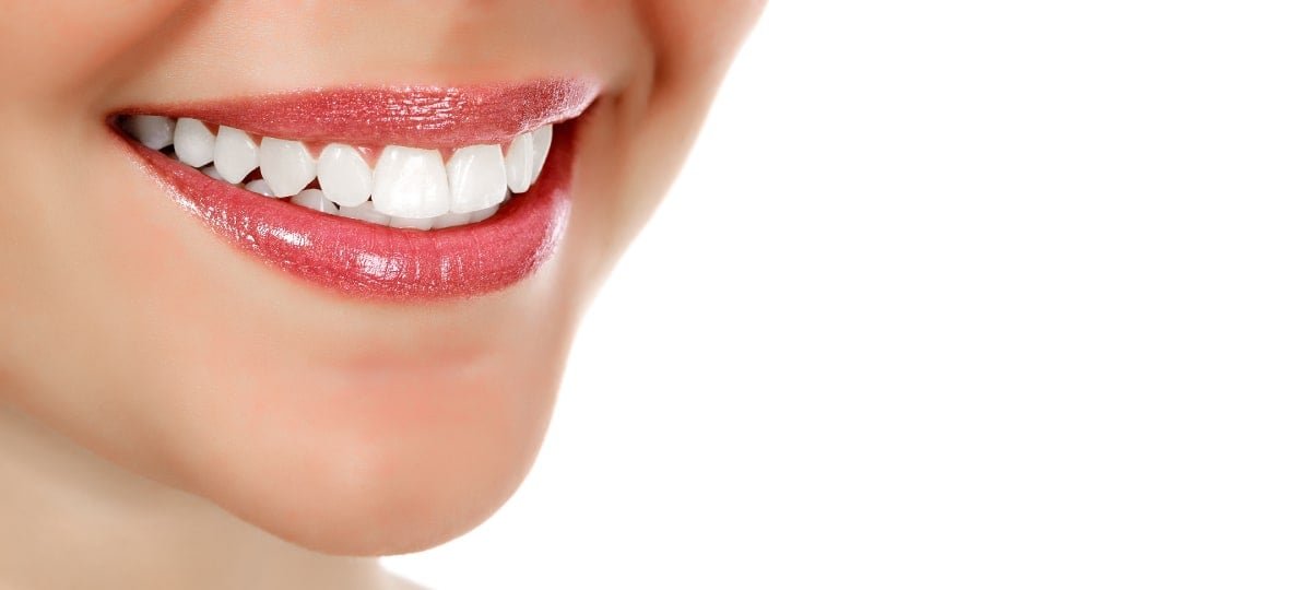What You Need to Know Before Getting Dental Veneers in Guelph