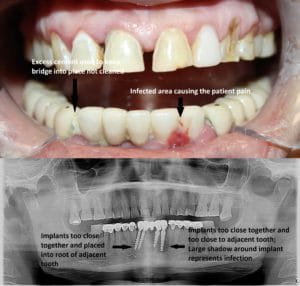 Guelph Dentist, Dentist Guelph, Dental Office Guelph, Guelph Dental Implants, Best Dentist Guelph
