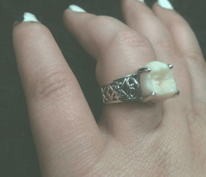 Wisdom Tooth Engagement Ring