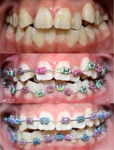dentist guelph, best dentist guelph, braces guelph, dental office guelph