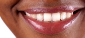 value-of-a-straight-smile-guelph-village-dental
