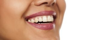 Pinhole Gum Grafting - Guelph Village Dental